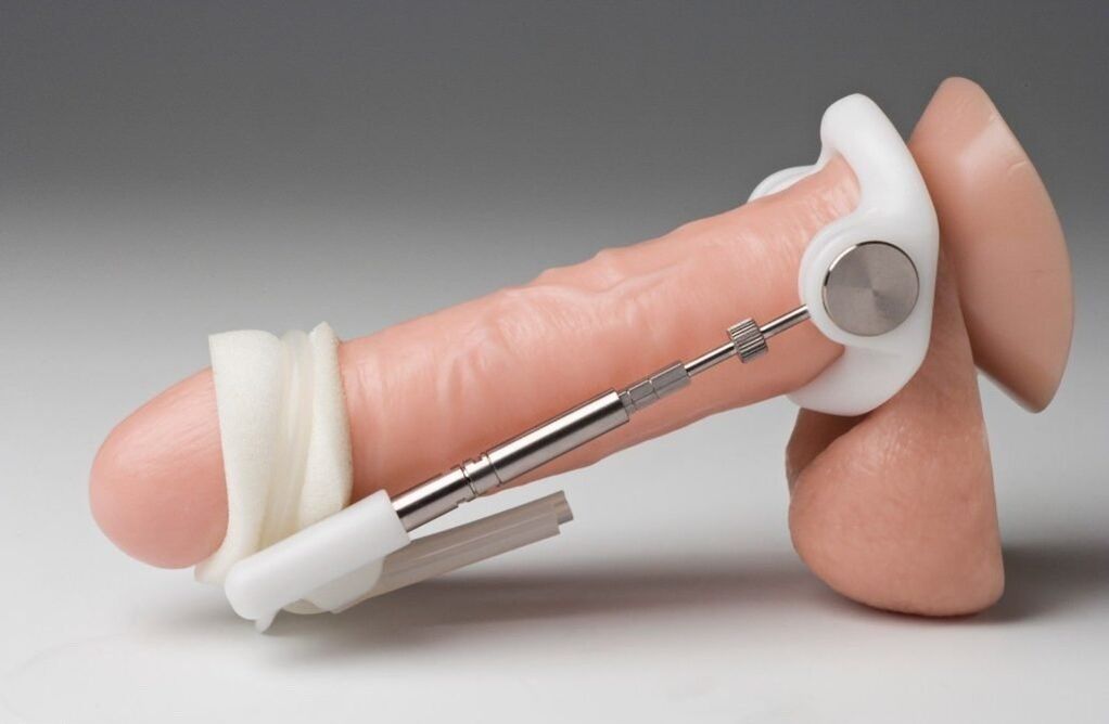 Extensor to increase penis thickness
